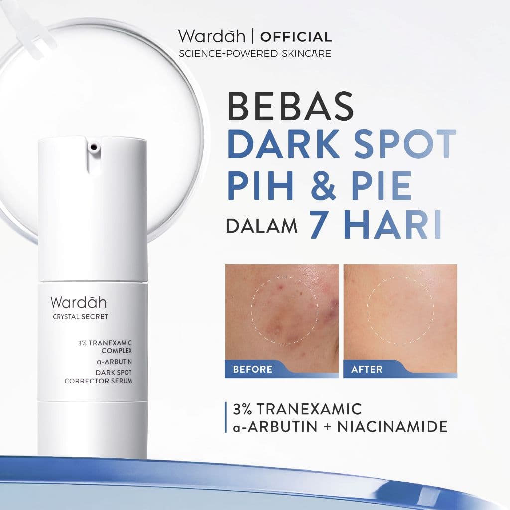 Wardah Crystal Secret Dark Spot Brightening Serum